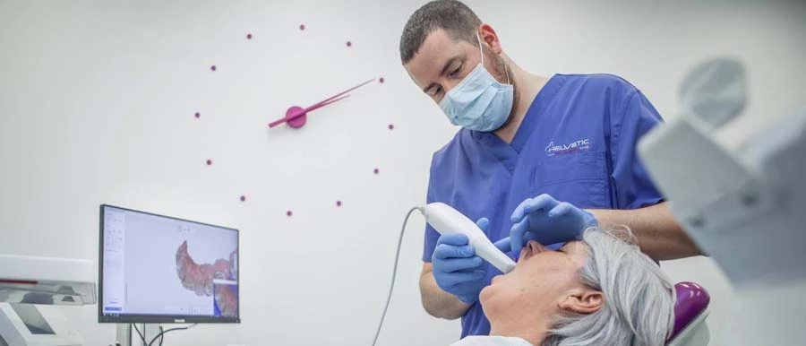 Digitális fogászat, szájszkenner